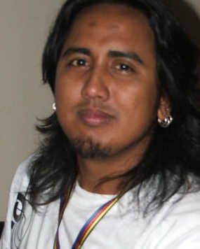 Operasi di Singapura, Gugun Gondrong Bisa Berkedip