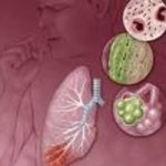 Diare dan ISPA Mulai Serang Warga Bandung