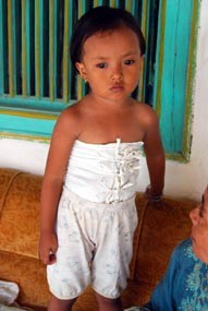 Demi Menutup Kotoran di Perut, Kudma Ngemis Kain Bekas