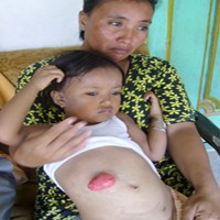 Ingin Sembuh, Windi Tanyakan Rembesan di Celananya