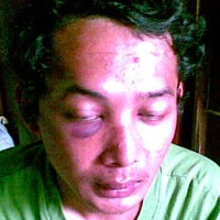 Al Amin Disumpah Anak Jenderal Hartono Agar Tidak Melapor