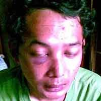 Aniaya Karyawan, Anak Jenderal Hartono Diperiksa Usai Idul Adha