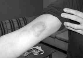 Kasus KDRT 2008 Meningkat