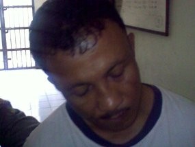 Lumpuhkan ATM Bermodal Korek Api