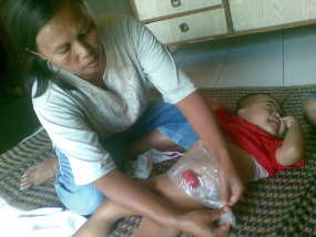 Tak Miliki Anus, Rivan BAB Lewat Usus