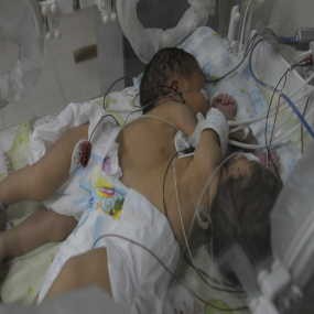 Berat Badan Menyusut,Besar Hati Tidak Sama