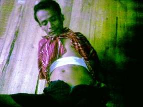 Menderita Polio, Triono Jarang Keluar Rumah