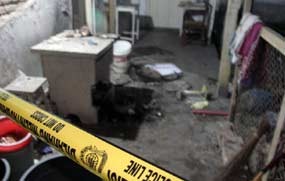 Korban Ledakan Bantul Diamputasi