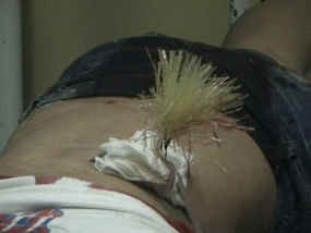 Dua Sejoli Kencan, Sang Gadis Terkena Anak Panah Misterius