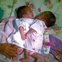 Sehari Sebelum Meninggal, Kondisi Bayi Stabil