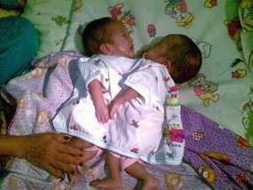 Sehari Sebelum Meninggal, Kondisi Bayi Stabil