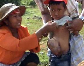 Ekonomi Pas-pasan, Nurul Hidup dengan Usus Keluar
