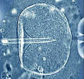 Wow! Wanita 66 Tahun Hamil 8 Bulan 