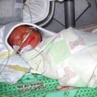 Seorang Ibu Lahirkan 6 Bayi Kembar di Irlandia