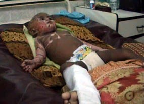 Wakil Bupati Perintahkan Fery Dirawat di RSU Pamekasan