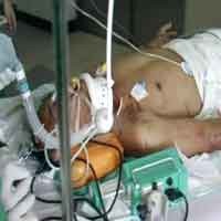 Tubuh Masih Panas, Mayor Dedi Masih di ICU