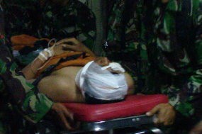 Kondisi Letda Agus Mulai Membaik