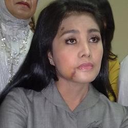 Ungkap Kronologi Ditabrak Suhaebi, Cici Paramida Banjir Air Mata