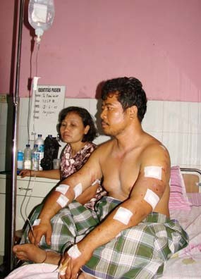 Lepas 2 Herder, Adik Ipar Majikan Aniaya Sopir Truk