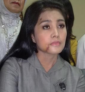 Keluarga Cici Masih Pikir-pikir Terima Ajakan Damai Suhaebi