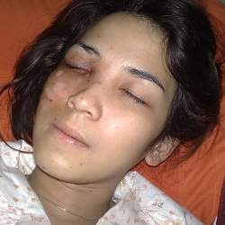 Dinda Kanya Dewi Kecelakaan, Skenario Cinta Fitri Berubah