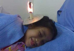 Terapi Lilin Tak Sekedar Buang Tahi Kuping