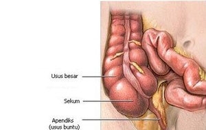 Usus Buntu
