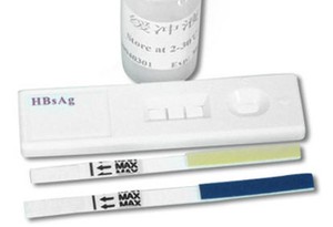 Lakukan Tes Hepatitis dengan Cepat