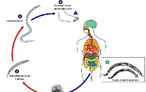 Nekatoriasis dan Akilostomiasis
