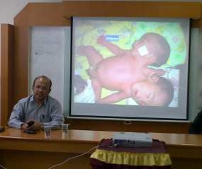 Bayi Berkepala Dua Riau Meninggal Dunia