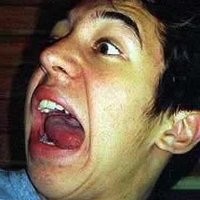 Penderita Sindrome Tourette yang Tak Pernah Tenang