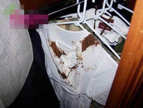 Kaus Penuh Darah Milik Michael Jackson Ditemukan di Lemari