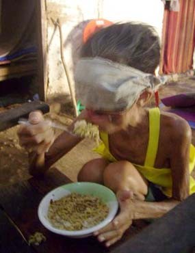 Tolak Operasi, Bantuan Ditabung dan Dibelikan Kambing