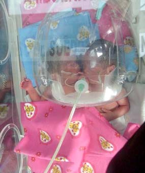 2 Jam Perawatan, Bagus Menyusul Kembarannya