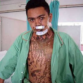Polisi Malaysia Disiram Air Keras oleh Mantan Istri