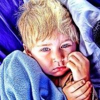 Kenali Tanda Anak Kurang Gizi