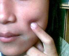 Kadisdik Akan Segera Panggil Rosnida 