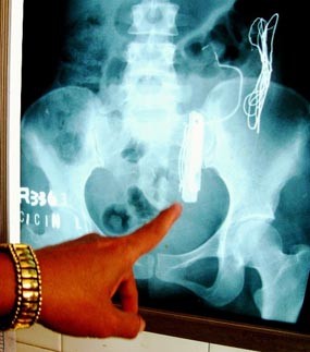 Sepekan Dirawat di RS, Cicin Meninggal Dunia