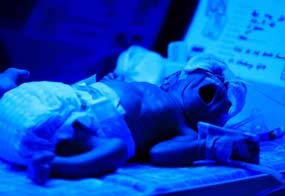 Reni Lahirkan Bayi Kembar Saat Gempa 7,3 SR di Tasikmalaya