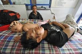 Operasi Bedah Tulang Mulai Dilakukan Hari Ini