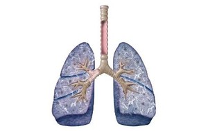 Idiopatik Pneumonia Interstisial