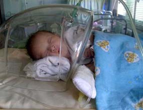 Bayi Tanpa Dinding Perut Lahir di Madiun 