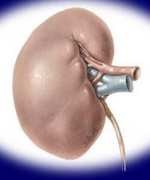 Ide Muncul dari Celetukan Teman