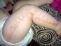 Kalangan Medis Terbelah Sikapi Quran di Tubuh Bayi