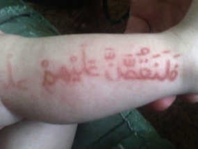 Massa Berdatangan, Baju Ali Jadi Rebutan