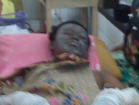 Luka Bakar Serius, Empat Korban Kapal Dirawat Intensif