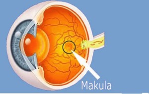 Degenerasi Makula