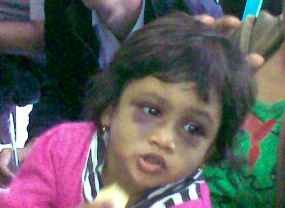 Balita Dianiaya Paman Hingga Lebam