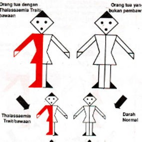 Hati-hati Jika Anak Berperut Buncit