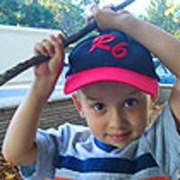 Lengan Titanium Redam Kanker Langka Bocah 3 Tahun